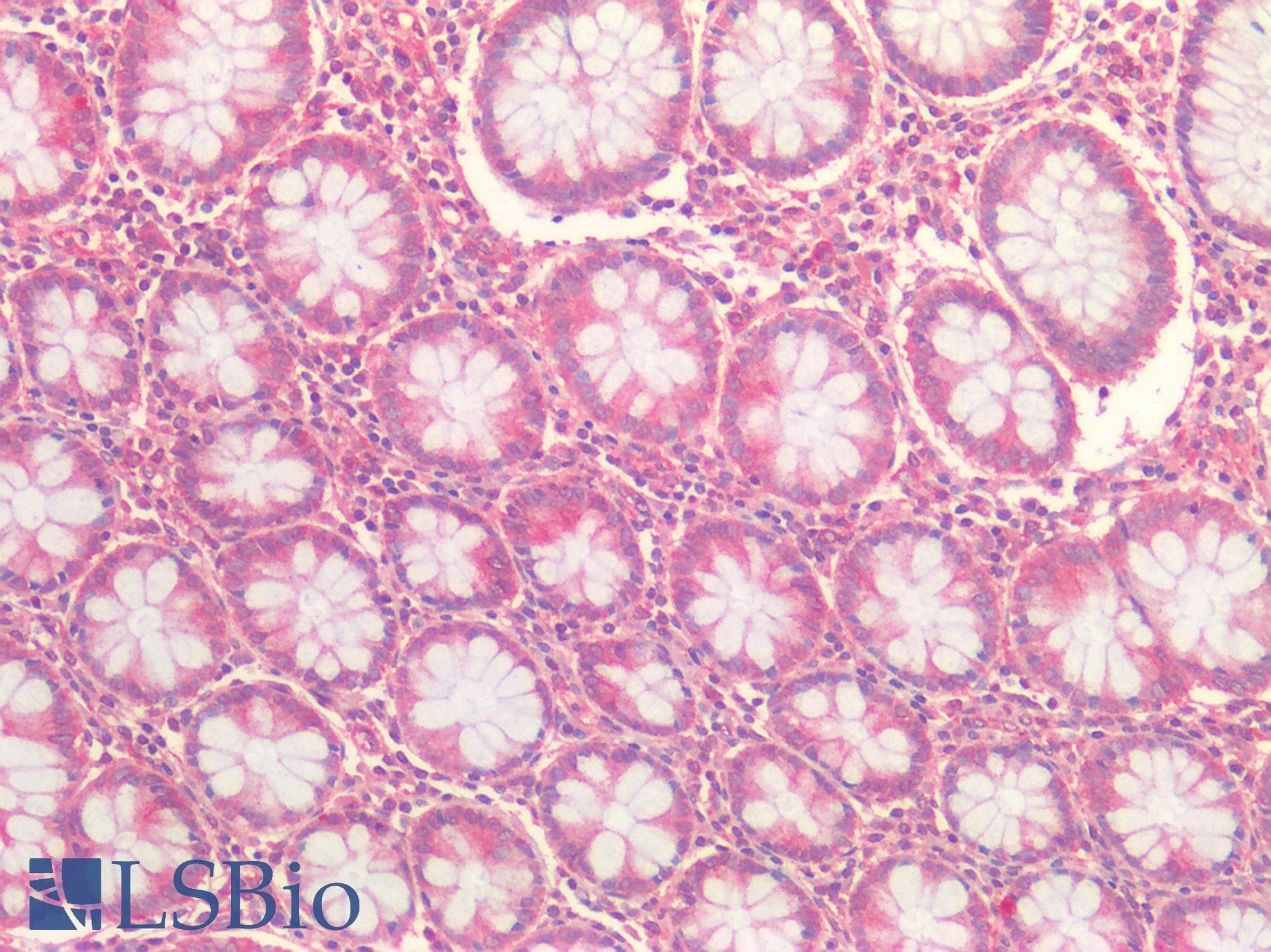 IHC-plus™ FZD7 / Frizzled 7 Antibody (N-Terminus)