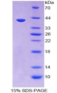 Human HIN-1 / SCGB3A1 Protein (Recombinant His-GST)