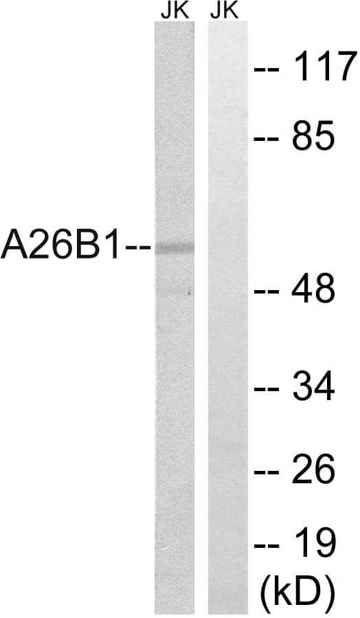 POTEB3 / POTE-15 Antibody (aa481-530)