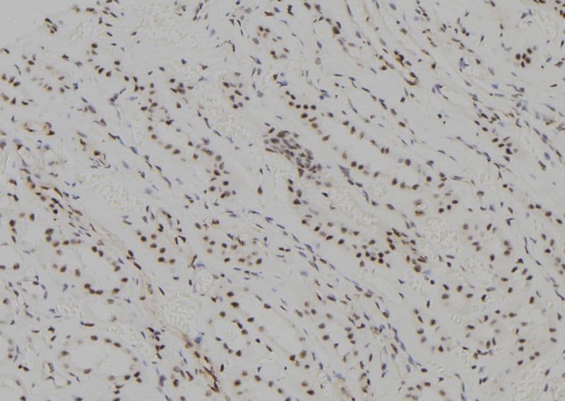 UBCH10 / UBE2C Antibody