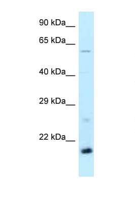 DR1 / NC2 Antibody (aa63-112)