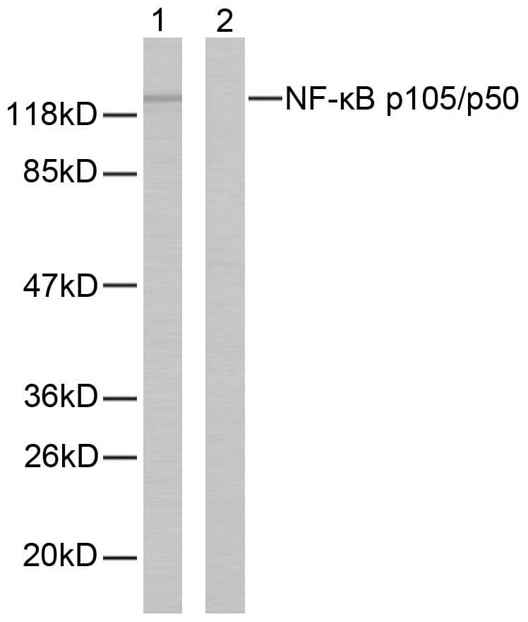 NFKB1 / NF-Kappa-B Antibody (aa304-353)