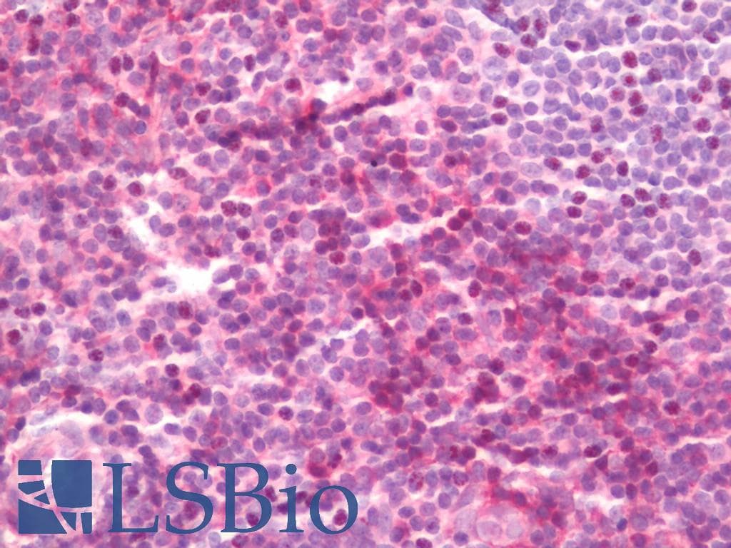 IHC-plus™ Polyclonal Rabbit anti-Human CYP24 / CYP24A1 Antibody (aa400-450, IHC, WB)