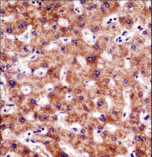 BCL7B Antibody (aa137-164)