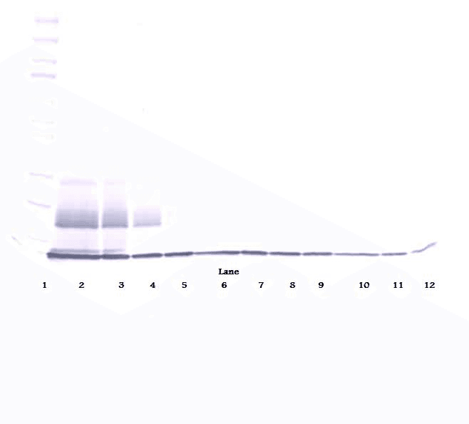 Polyclonal Rabbit anti-Human CCL27 Antibody (Biotin, WB)