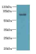Polyclonal Rabbit anti-Human TTC30A Antibody (IHC, WB)