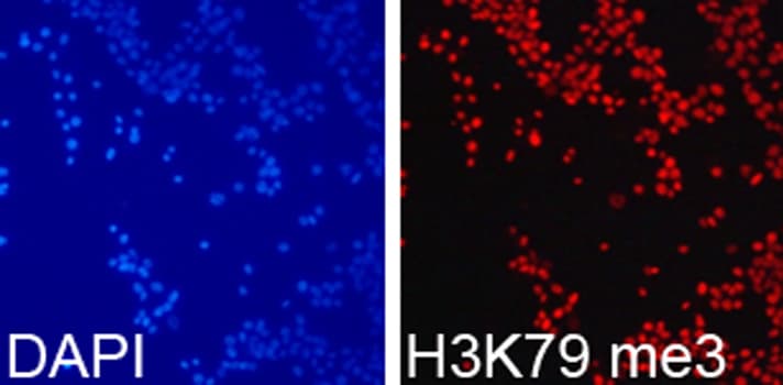Histone H3 Antibody (Tri-Methyl-Lys79)