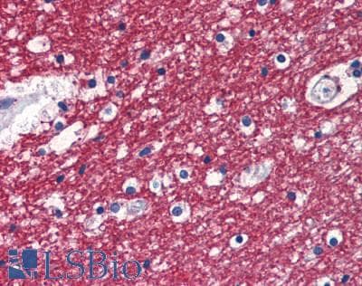 SPARCL1 / Hevin Antibody (aa298-545)