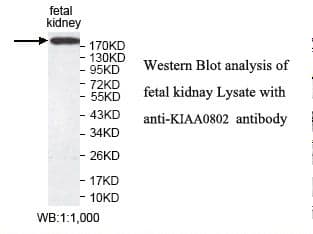 IHC-plus™ MTCL1 / SOGA2 Antibody (aa13-202)