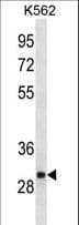 Polyclonal Rabbit anti-Human VAP33 / VAPA Antibody (aa182-210, WB)