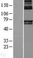Human ALAS1 Protein (Over-Expression Lysate Myc-DDK (Flag))