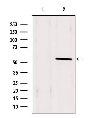 Polyclonal Rabbit anti-Human PAX1 Antibody (IHC, WB)