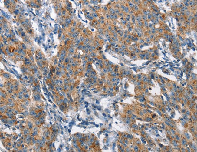 CHMP1A Antibody