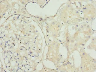 TAGLN2 / Transgelin 2 Antibody