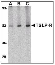 IHC-plus™ Polyclonal Rabbit anti-Human CRLF2 / TSLPR Antibody (IHC, IF, WB)