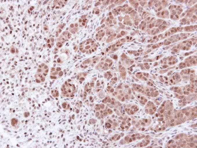PSMA7 Antibody (aa1-205)