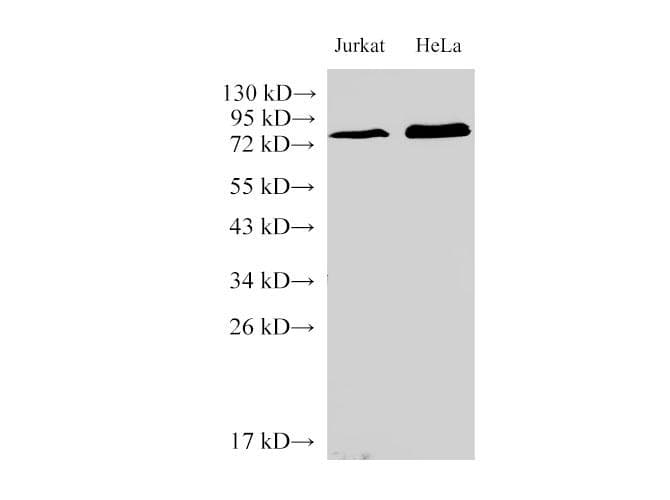 IL6R / IL6 Receptor Antibody