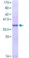 Human FSH Receptor / FSHR Protein (Recombinant GST, N-terminus)