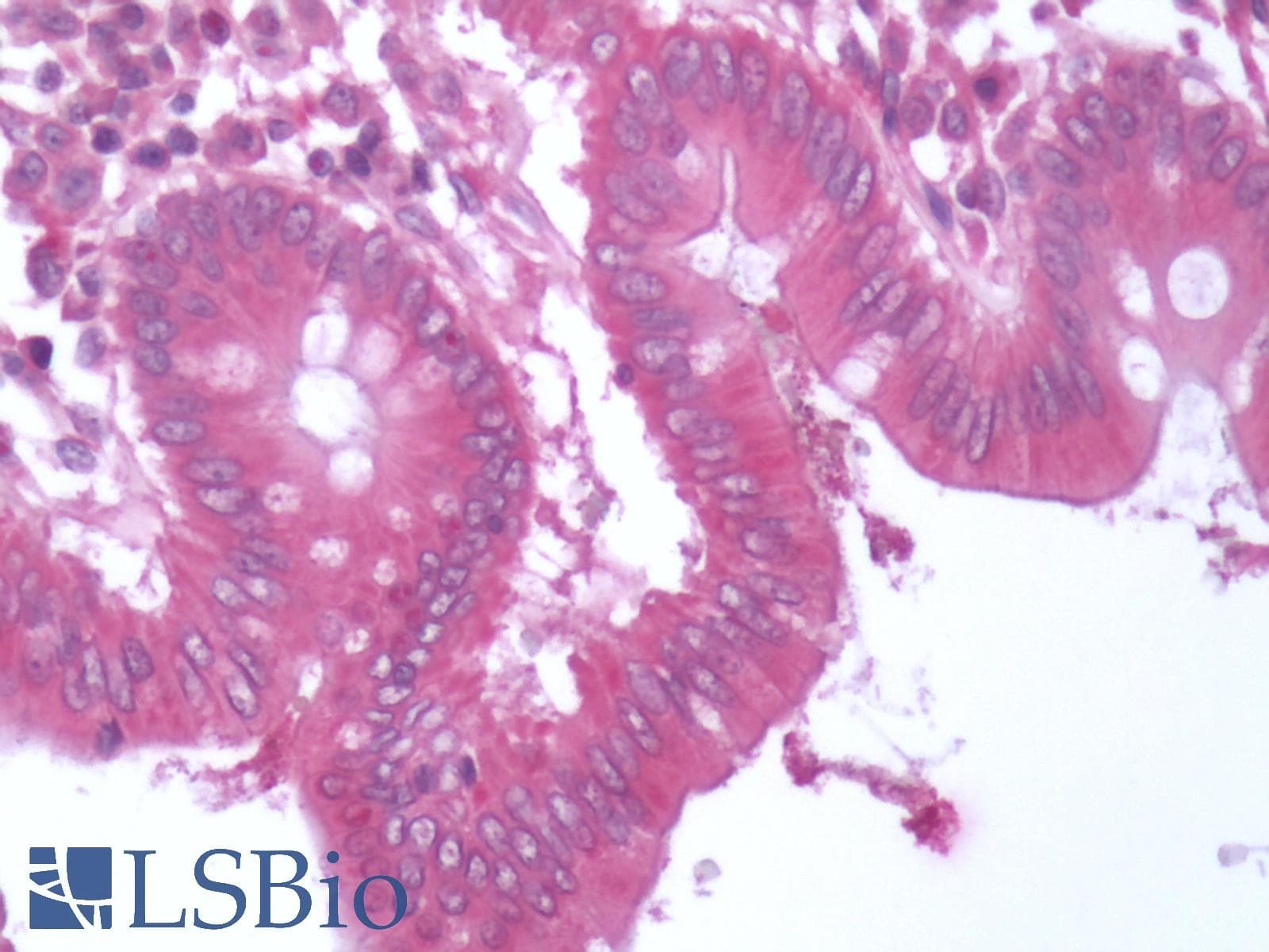 IHC-plus™ BACE1 / BACE Antibody (C-Terminus)