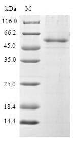 Human BCAS2 Protein (Recombinant GST, N-terminus)