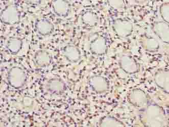 MRPL49 Antibody
