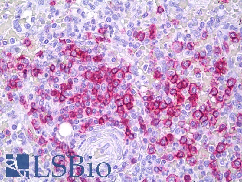 PathPlus™ CD45RB Antibody (clone MEM-55)