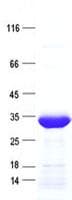 Human CITED2 Protein (Recombinant His, N-Terminal)