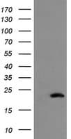 COMMD1 Antibody (clone OTI1F2)