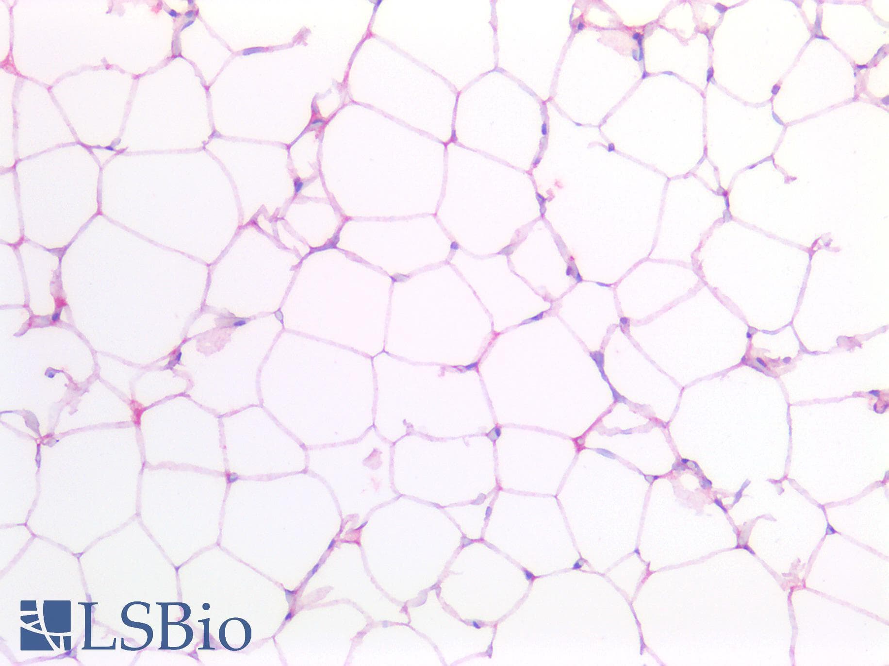 PathPlus™ Monoclonal Mouse anti-Human GLUL / Glutamine Synthetase Antibody (clone AT8D7, IHC, IF, WB)