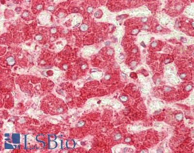 IHC-plus™ Polyclonal Rabbit anti-Human RPL7 / Ribosomal Protein L7 Antibody (C-Terminus, IHC, WB)