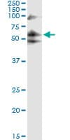 PFK2 / PFKFB3 Antibody (clone 3F3)