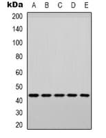 MAPK14 / p38 Antibody (phospho-Tyr182)