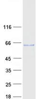 Human B3GALNT2 Protein (Recombinant Myc-DDK (Flag))