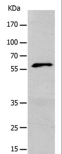 Polyclonal Rabbit anti-Human KCNC1 / Kv3.1 Antibody (IHC, WB)