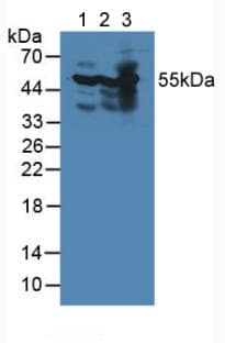 PDHX / Protein X / ProX Antibody (aa222-471, APC)