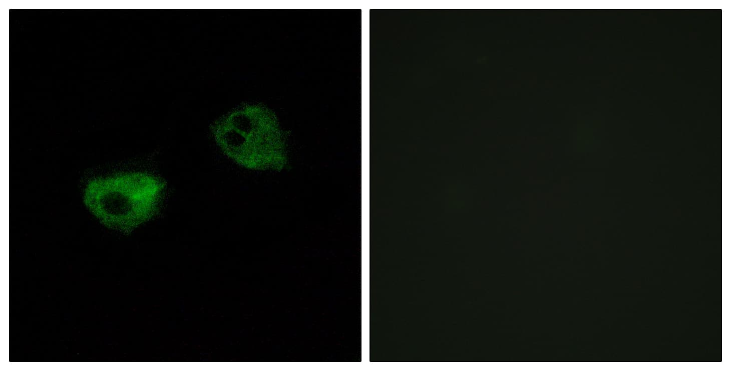 Polyclonal Rabbit anti-Human MTNR1A / Melatonin Receptor 1a Antibody (aa191-240, IF)