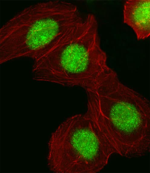 HMGIY / HMGA1 Antibody (aa64-93)