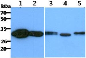 CBR / CBR1 Antibody (clone AT2D6)
