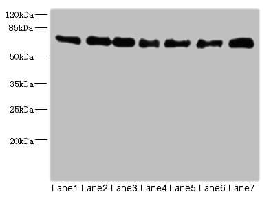Polyclonal Rabbit anti-Human NUMB Antibody (WB)