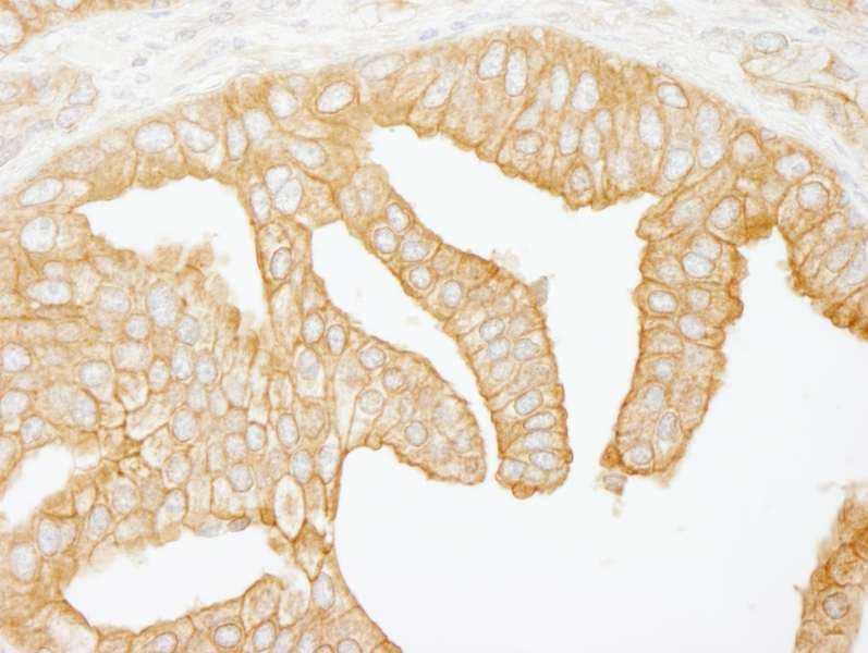 FLNB / TAP Antibody (aa2552-2602)