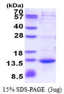 Human CAMK2N1 Protein (Recombinant His)