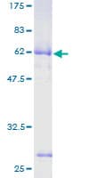 Human ASPHD2 Protein (Recombinant GST)