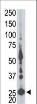 AK5 / Adenylate Kinase 5 Antibody (aa404-433)