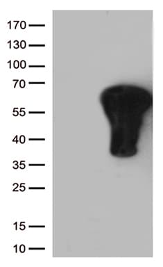 FOS / c-FOS Antibody (clone UMAB221)