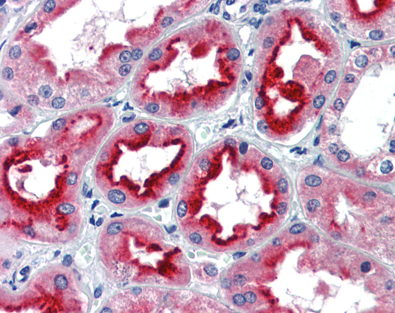 SIN3A Antibody (N-Terminus)