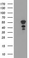 Monoclonal Mouse anti-Human KATNAL1 Antibody (clone OTI1A7, IHC, WB)