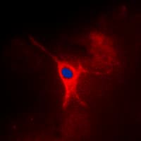 Polyclonal Rabbit anti-Human PRKAG2 / AMPK Gamma 2 Antibody (N-Terminus, IHC, IF, WB)