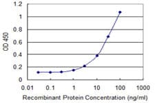 MAP1LC3B / LC3B Antibody (clone 4G7)