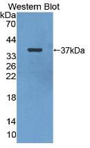 ENO2 / NSE Antibody (aa2-434, Cy3)