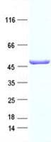 Human TNNT1 / TNT Protein (Recombinant DDK,C-terminus)